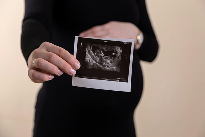 How to Prepare for Your First Ultrasound