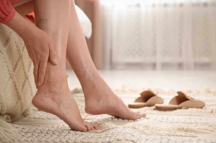 Vein Health for Expectant Mothers